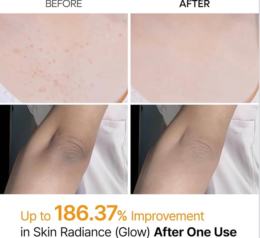 Kojic Acid Dead Skin Remover Spray