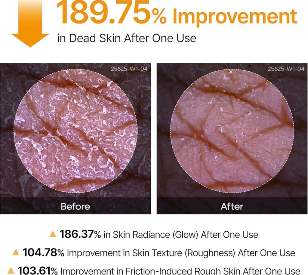Kojic Acid Dead Skin Remover Spray